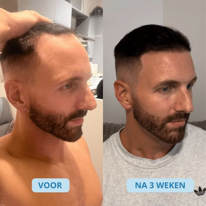 Wortel Revive Haargroei Olie